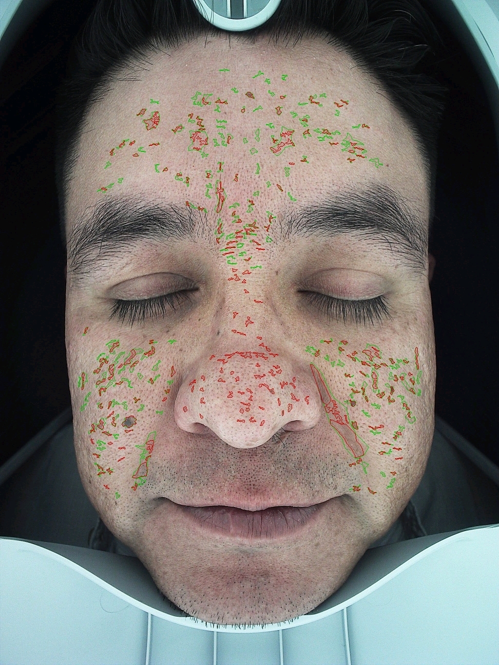 Magic Mirror galería 5